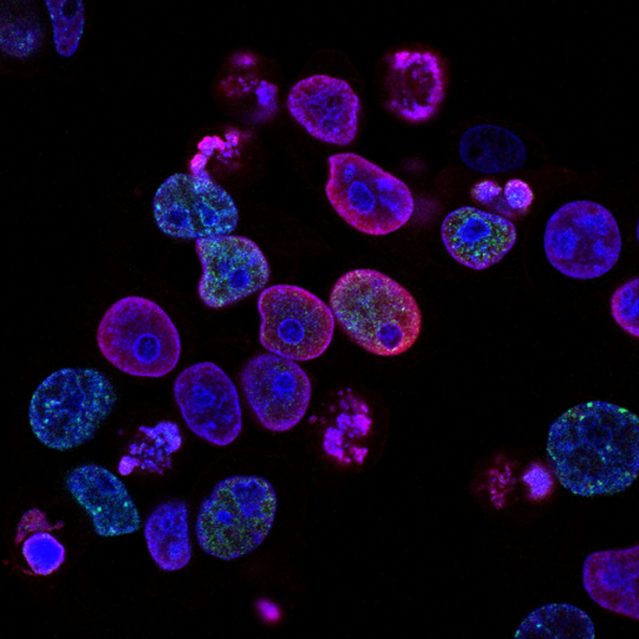 Keto For Cancer Resource Page Heads Up Health