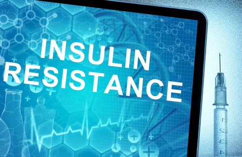 Insulin Load – Beyond “Counting Carbs”