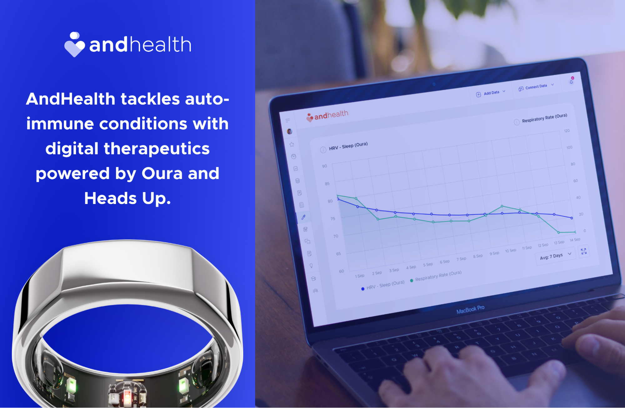 Use Oura Ring Location Services - Map Your Workout Route Now